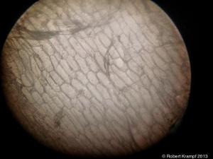 Onion cells